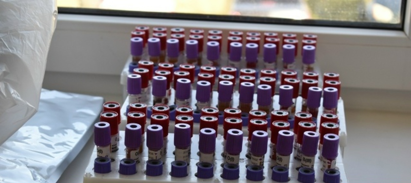 Какие типы рака наиболее часто диагностируют в Башкирии