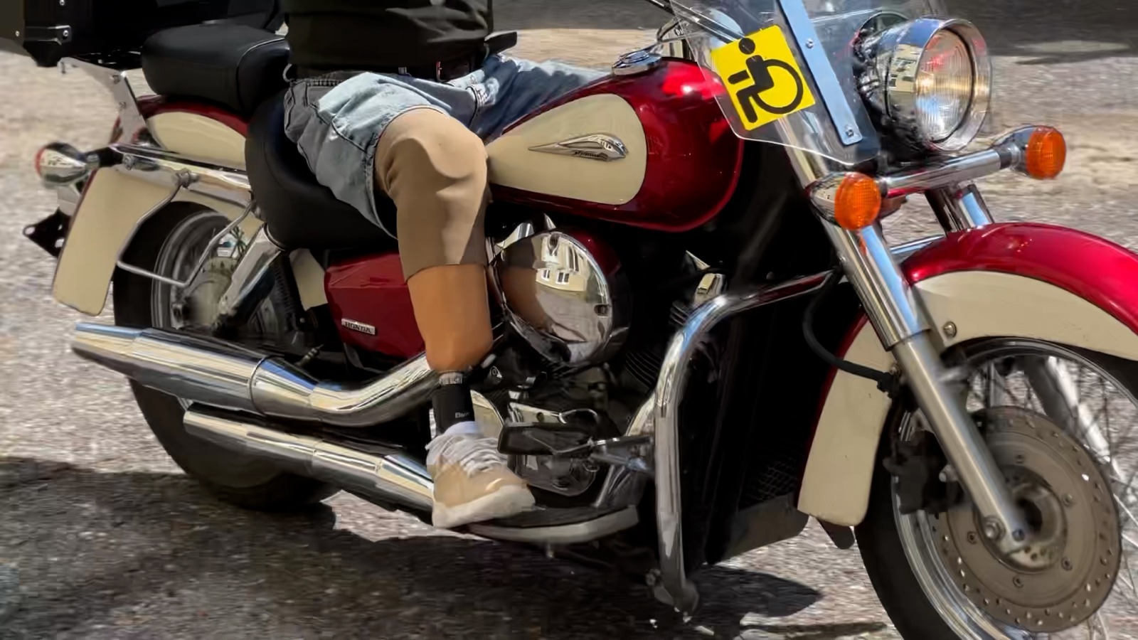 Новый протез для подопечного республиканского фонда «Защитники Отечества»